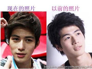 娱乐圈吃瓜爆料男星整容,男星整容风波，真相背后竟是这样...